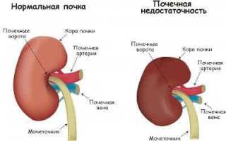 Нервная система при хпн